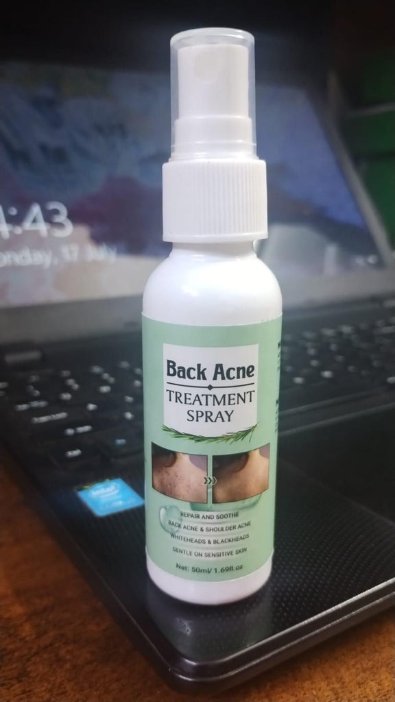 Back Acne Treatment Spray (Pack of 1) - Timecraze