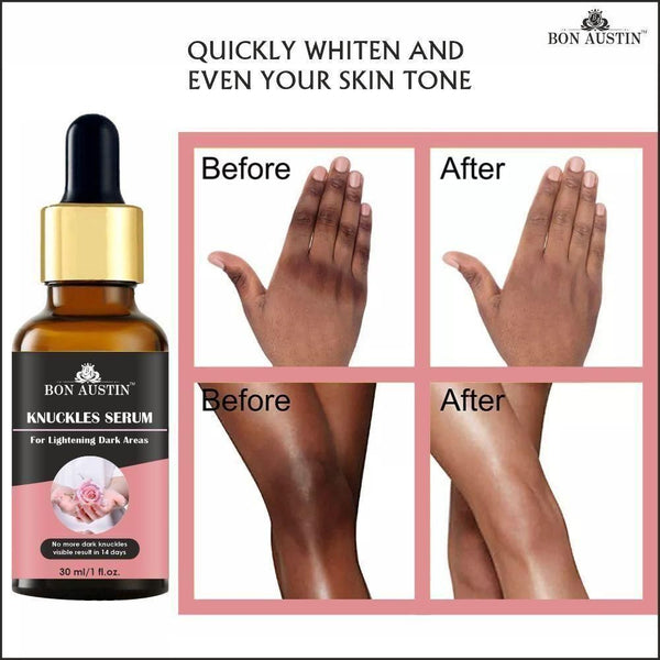 Bon Austin Skin Whitening Serum - Timecraze